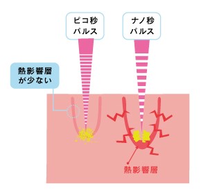 ピコスポット