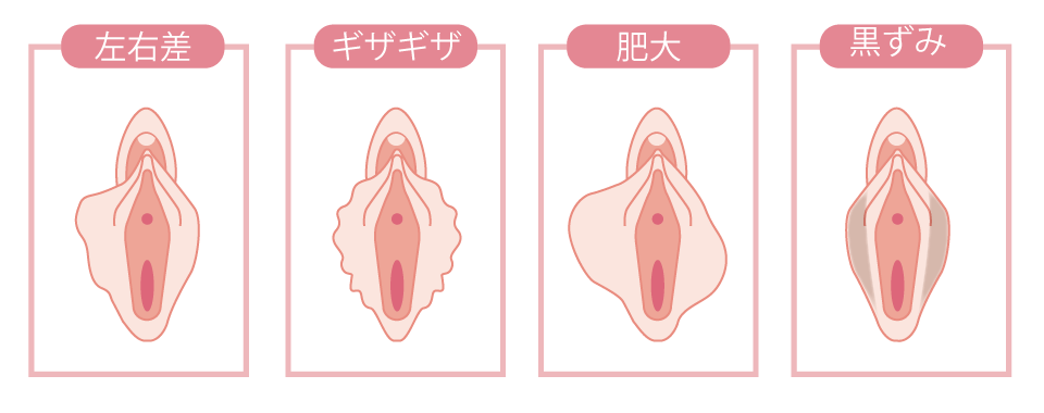 美容婦人科(婦人科形成)とは